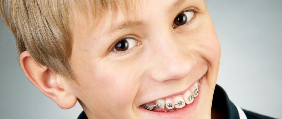 Ребенку 2 года 12 зубов. Брекеты для зубов для детей 10 лет.