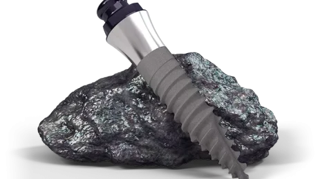 Visual_Mini_Implant_Roxolid_RGB_Transparent_AEM
